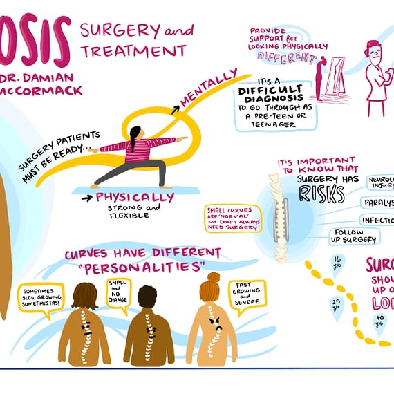 scoliosis graphic recording, scoliosis treatment and surgery, live drawing virtual meeting, virtual meeting graphic recording, visual scribe, graphic facilitation